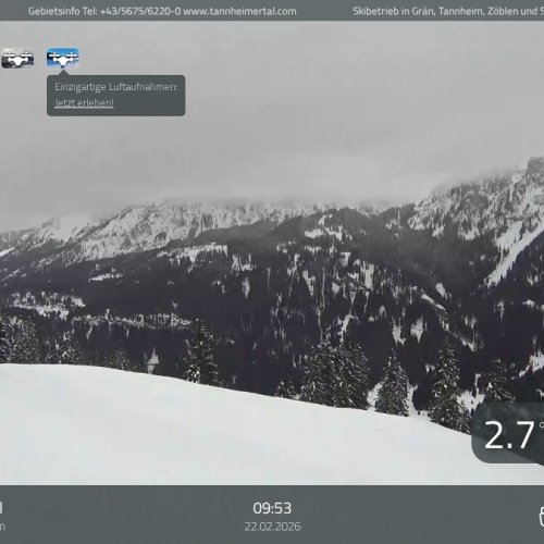 Nesselwängle Krinnenalpe Live Webcam: Alpine Views in HD